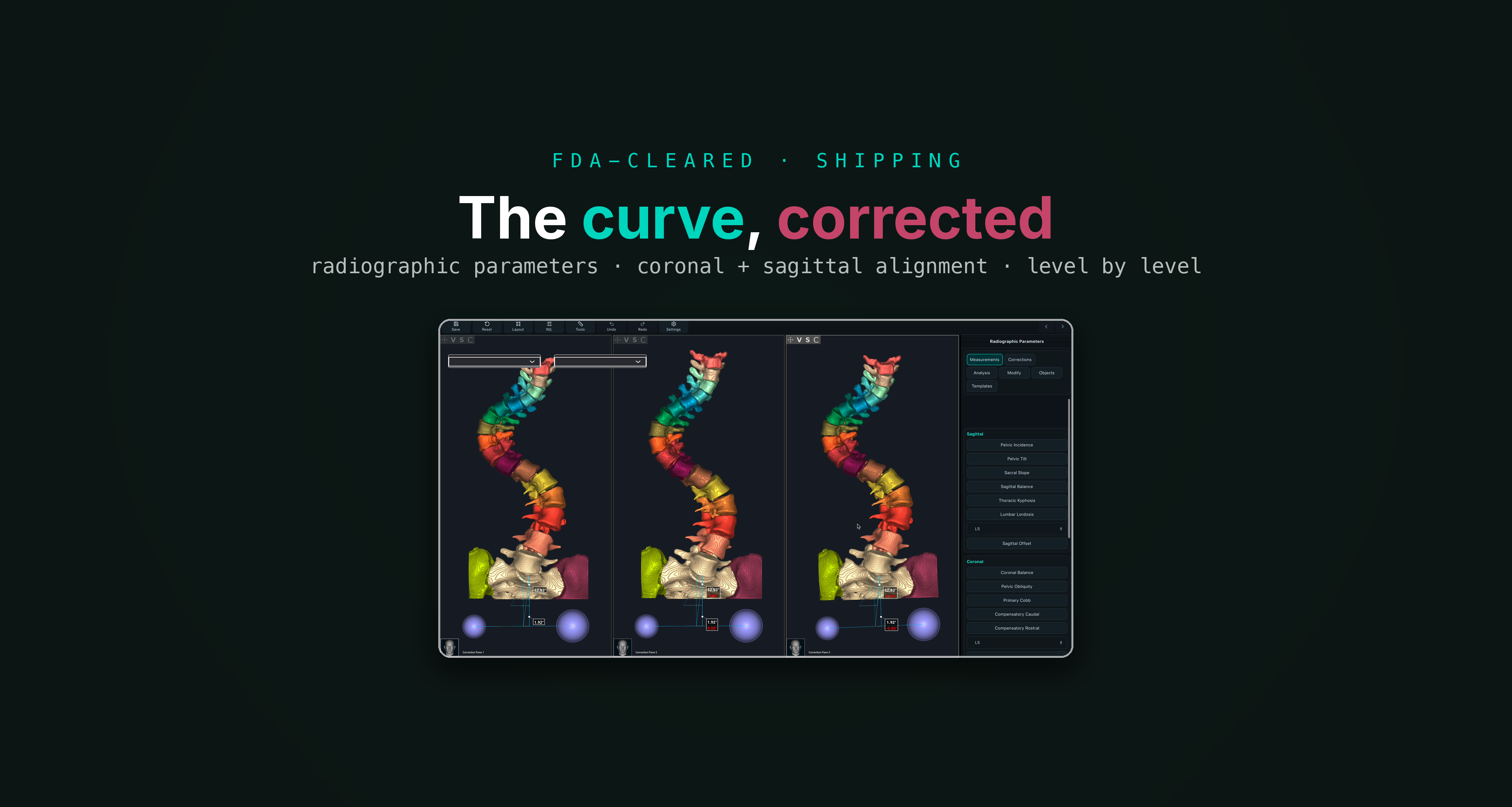 Deformity-correction planning